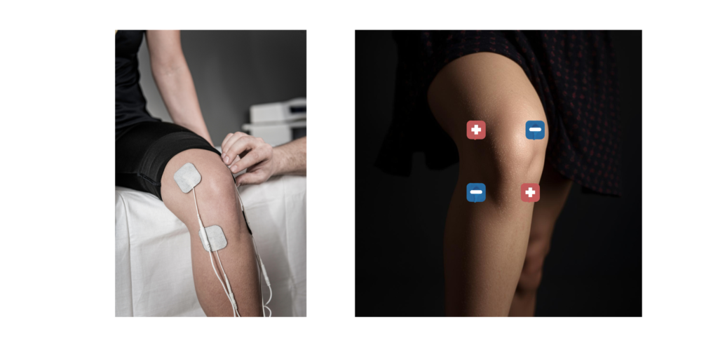 Image: Person using a TENS unit on their knees

Alt: Pessoa utilizando aparelho TENS para alívio da dor nos joelhos