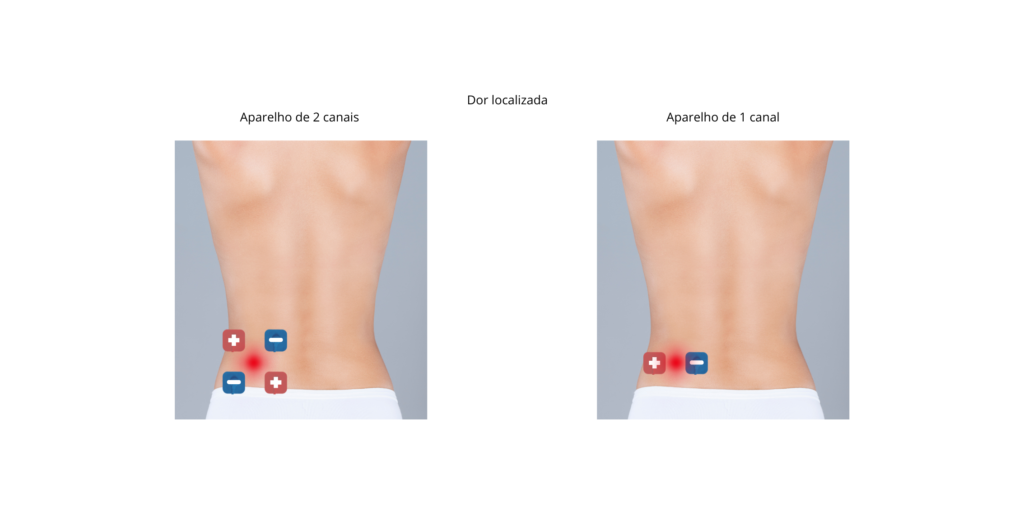 Image: Person using a TENS unit on their lower back for localized pain

Alt: Pessoa utilizando aparelho TENS para alívio da dor lombar localizada