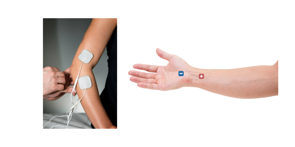 Image: Person using a TENS unit on their upper limb

Alt: Pessoa utilizando aparelho TENS para alívio da dor no braço, antebraço e punhos